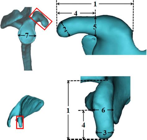 The Coracoid Process And Glenoid Cavity Measurements 1 Coracoid