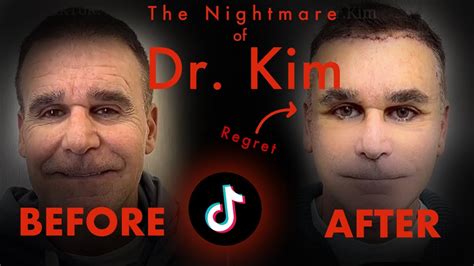 The Nightmare Of Dr Kim Plastic Surgery Youtube