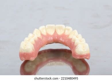 Fixed Dental Prostheses Over 75 Royalty Free Licensable Stock Photos