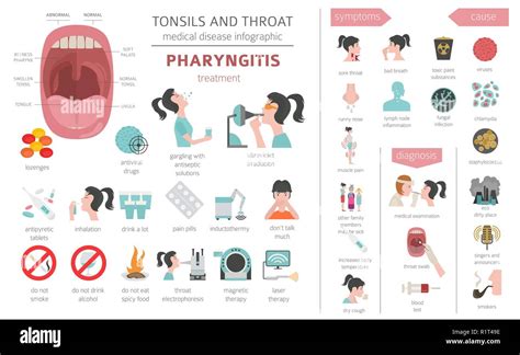 Chlamydia Throat Treatment