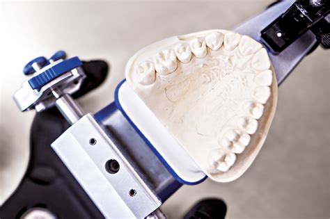 Caratteristiche Ideali Dei Modelli In Gesso In Odontotecnica