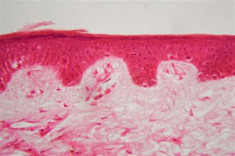 Detail of Skin Under the Microscope. Stock Photo - Image of anatomy ...