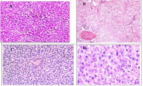 Light Microscopy Of Liver Sections Showing A Control Group A Normal