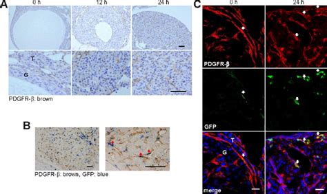 Immunohistochemistry For Pdgfr B A Double Immunostaining For