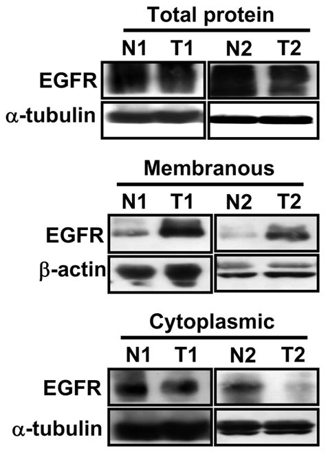 Detection Of Membranous And Cytoplasmic Egfr In Normal Parenchymal And