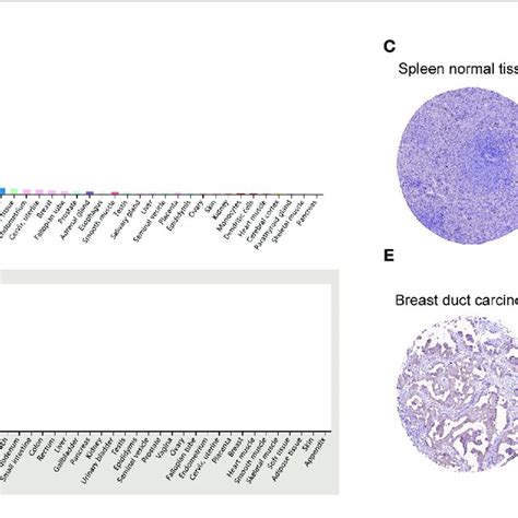 CD96 Expression Profiles In Human Normal And Cancer Tissues A CD96