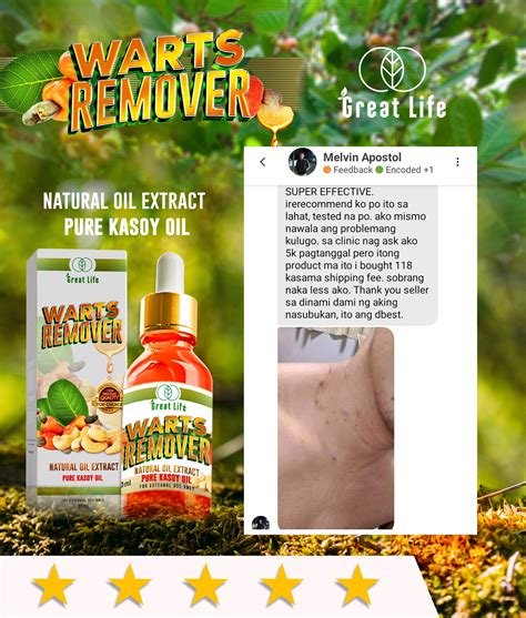 Skin... - Skin Essentials Anti-fungal and Warts Remover