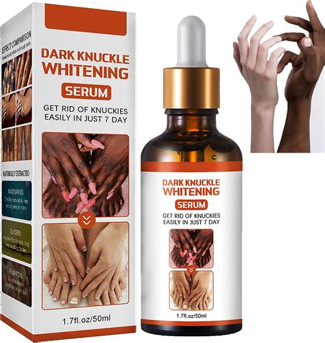 Dark Knuckle Whitening Serum Dark Knuckle Whitening Cream For Dark