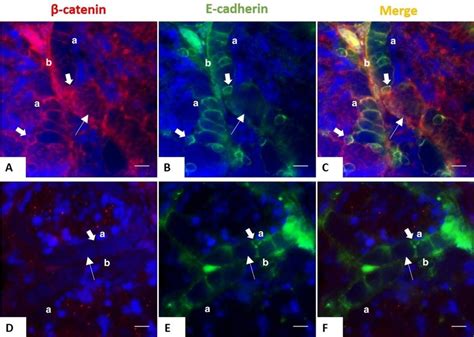 Expression Of E Cadherin And β Catenin In Sertoli Cells During Download Scientific Diagram