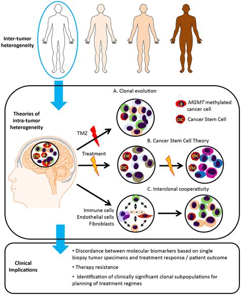 Glioblastoma Tumor Heterogeneity And Implications For Patient