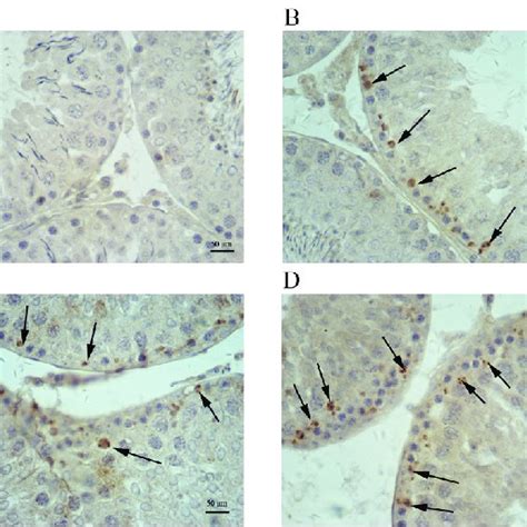 Immunohistochemical Staining For Cox In Testis Samples Cox