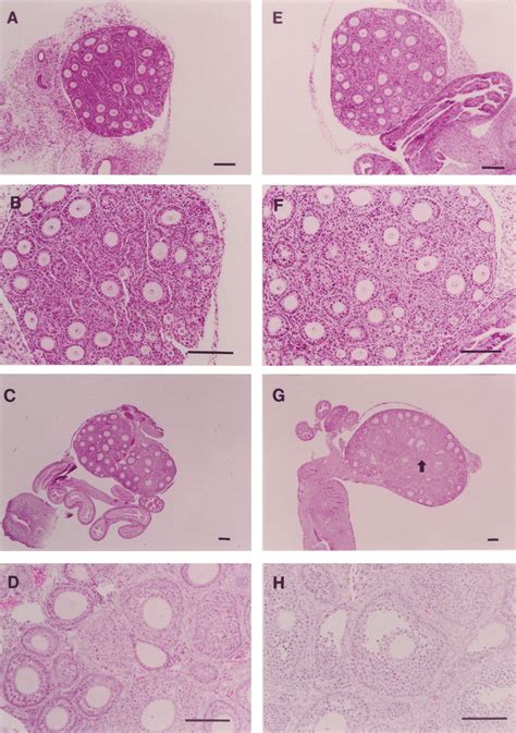 Prepubertal Ovarian Phenotype In The Erko Mouse A 25 And B 50 Download Scientific Diagram