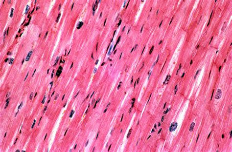 Light Micrograph Of Cardiac Muscle Photograph By Astrid Hanns Frieder