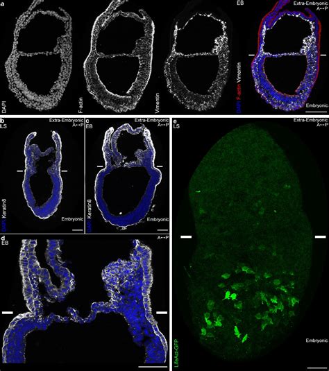 Distinct Mesoderm Migration Phenotypes In Extra Embryonic And Embryonic