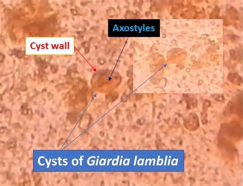 Giardia Lamblia Cyst