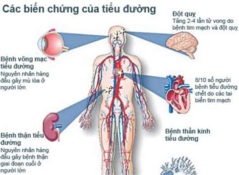 Những điều Cần Biết Về Bệnh Tiểu đường