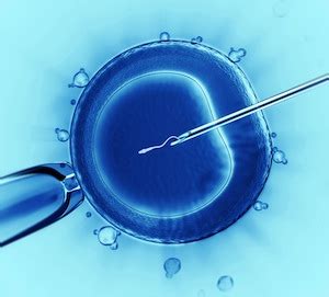 Artificial Insemination Dfw Center For Fertility Ivf