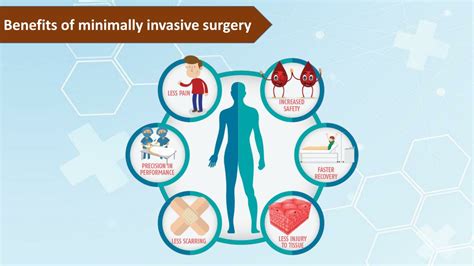 Ppt Minimally Invasive Surgery Powerpoint Presentation Free Download