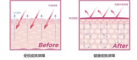 敏感肌红血丝用什么水乳揭晓敏感肌该怎么护肤 知乎