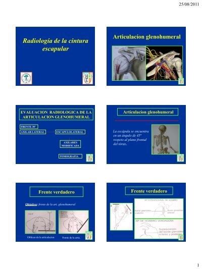 Radiologia De La Cintura Escapular