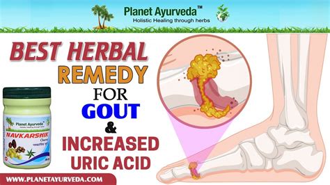 Best Ayurvedic Remedy For Gout Herbal Treatment Youtube