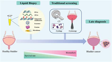 Recent Development Of Urinary Biomarkers For Bladder Cancer Diagnosis