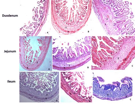 Duodenum Jejunum Ileum Histology