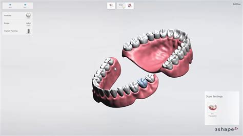 Implant Studio 1edentulous Case How To Set Up A Case Youtube