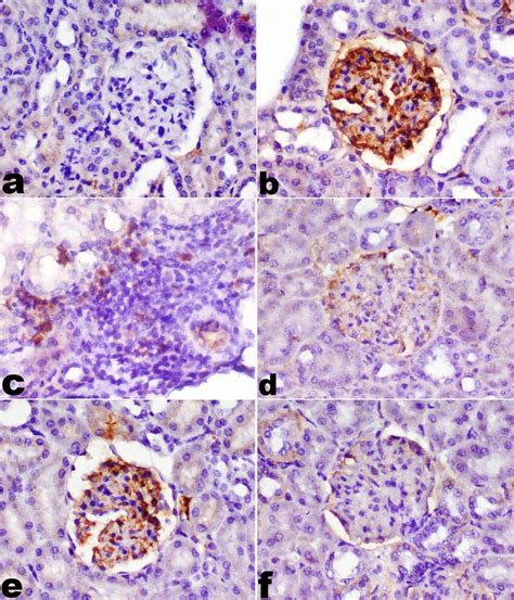 Immunohistochemistry of TNF α expression in renal tissue in different