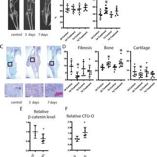 Nefopam Treatment Increases Osteogenesis During Fracture Healing In Old