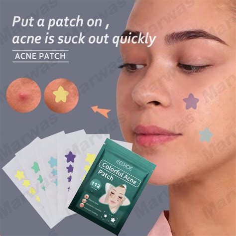 112pcs Acne Patch Pimple Treatment Stiker Spot Patch Acne Treatment