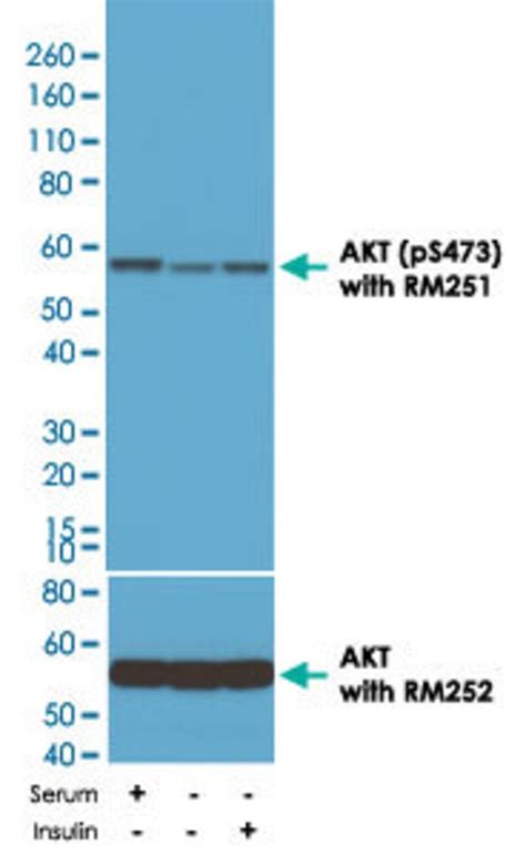 Akt Phospho S473 Rabbit Anti Human Clone Rm251 Abnova™ 100ul