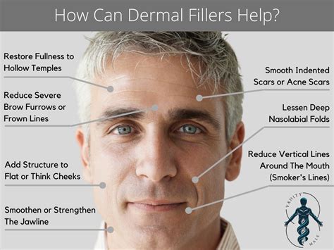 Dermal Fillers For Men In Bergen County Nj Vanity Male