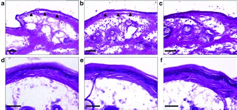 Anti Mlama Igg Induced Dermal Epidermal Separation Ex Vivo Depends On