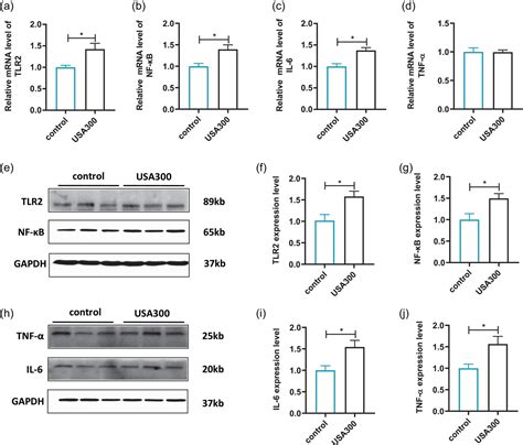 Microglia Activation In The MPFC Mediates Anxietylike Behaviors Caused