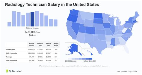 Radiology Technician Salary Hourly Rate January 2025 Usa