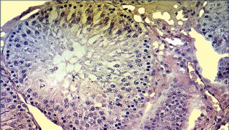 Photomicrograph Of Testis Section From Rj Treated Group 100 Mg Kg