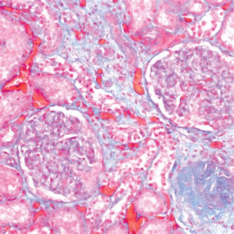 Fibrin Weigert Stain Method