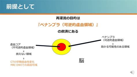 超急性期脳梗塞 静注血栓溶解療法、血管内治療の適応を見逃さない！【advanced】 Ppt