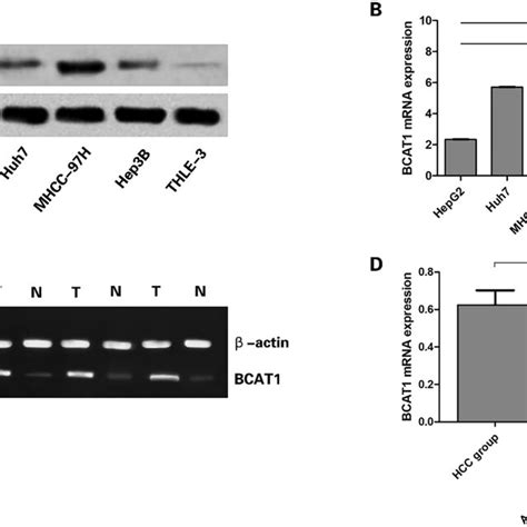 Expression Of BCAT1 In HCC Cell Lines And Tissues A BCAT1 Protein