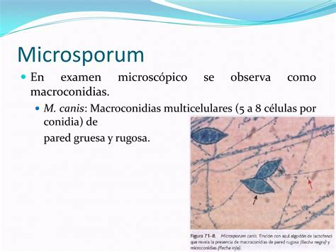 Micosis superficiales cutáneas y subcutáneas PPT