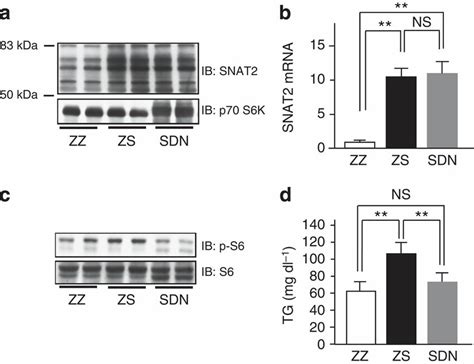 Blockage Of SNAT2 Induced Hepatic MTORC1 S6K Activation Improves