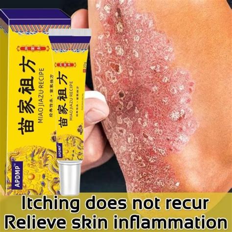 7 Day Effective Psoriasis Eczema Antibacterial Anti Itching Anti