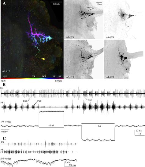 A Examples Of Ips Wedge Neurons Shown As Whole Mounts In Frontal