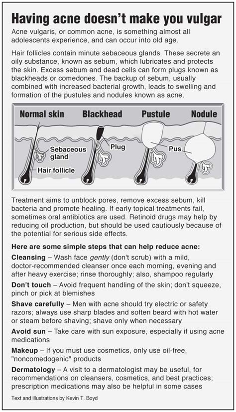 Acne Vulgaris Pointfinder Health Infographics