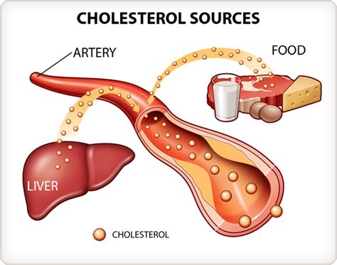 You Have High Cholesterol, Now what? - Austin Thyroid and Endocrinology