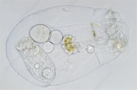 Freshwater Rotifer Asplanchna Stock Image C0127505 Science