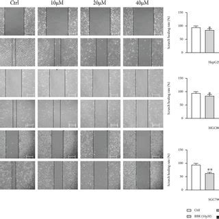 Bbr Inhibited Migration And Invasion Of Hepg Mgc Cells And