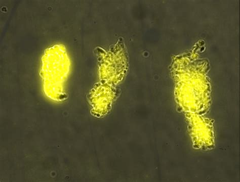 Fluorescence Microscopy Bacteria