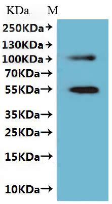 Recombinant Human Claudin Cldn Vlps Fluorescent Active Cusabio